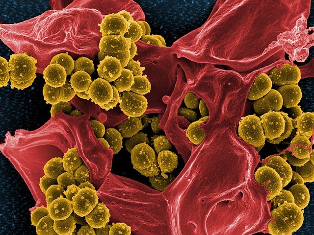 Makine Öğrenmesiyle Tanımlanan Kolorektal Kanser İçin Mikrobiyal İmza