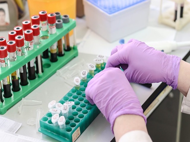 Tümör Hücrelerini Tam Kandan Ayırıp Sıralayan Sistem
