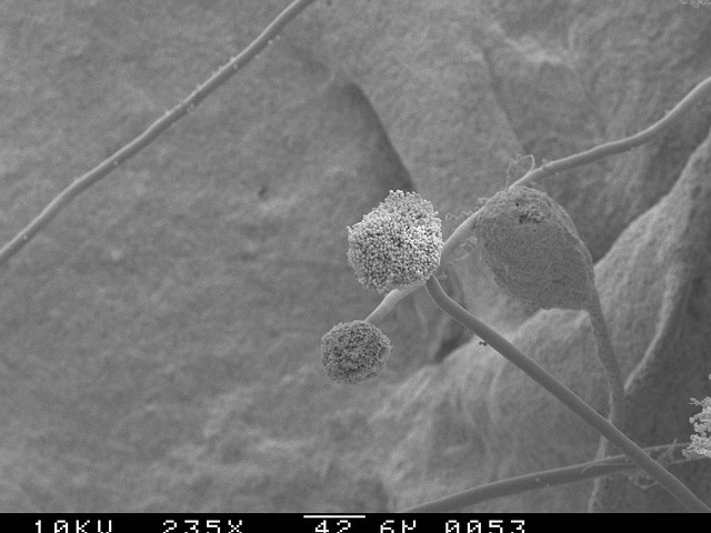Mikroskobik Boyutlu Mantar “Aspergillus Fumigatus” Bağışıklık Sistemini Nakavt Ediyor 