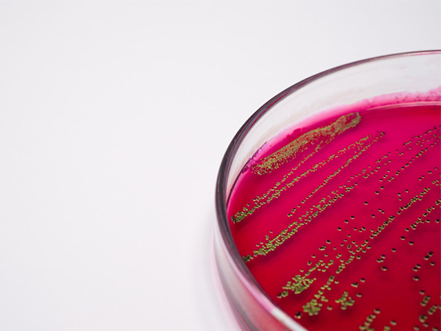 Biyoalgılama için Protein Nanotelleri Oluşturan Bakteriler
