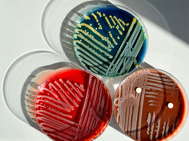 Yeni Tedavi Stratejileri için Bakteriyel Hareketin Araştırılması