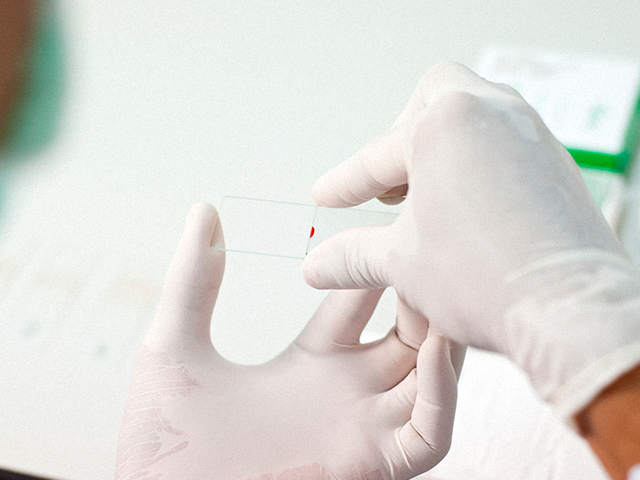 Güvenilir Sıtma Teşhisi için Otomatik Kan Testi