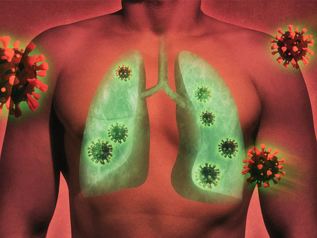 COVID-19 Akciğer Hasarını Tanımlayan Yenilikçi Yapay Zeka Teknolojisi