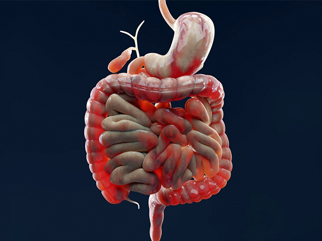 Hirschsprung Hastalığı için Kök Hücre Tedavisinin Potansiyeli