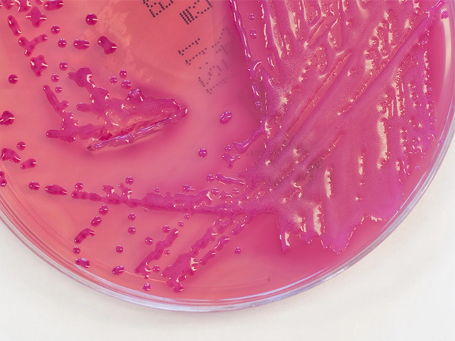 Dakikalar İçinde Antibiyotik Direncini Tespit Eden Yeni Test