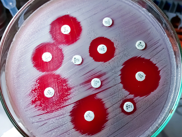 Yeni Bakteri Staphylococcus Borealis'te Antibiyotik Direnci Keşfedildi
