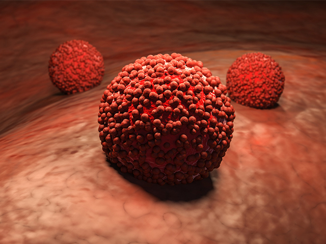 Optimize Edilmiş Kanser Tedavisi için Nanopartiküller