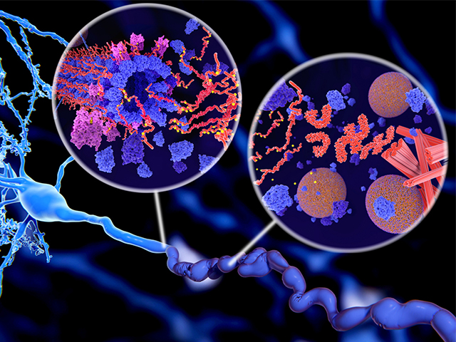 Alzheimer Hastalığına Bağlı Proteinlerin Nöronal Büyümeyi Nasıl Etkilediğine Işık Tutan Araştırma 