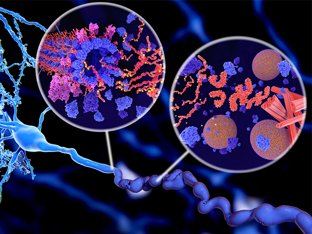 Alzheimer Hastalığına Bağlı Proteinlerin Nöronal Büyümeyi Nasıl Etkilediğine Işık Tutan Araştırma