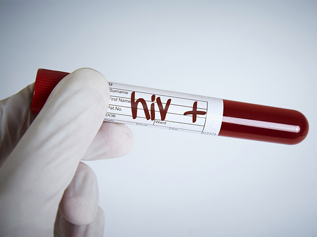 HIV'li Kadınlar için Rahim Ağzı Kanseri Tedavisine Erişimin İyileştirilmesi